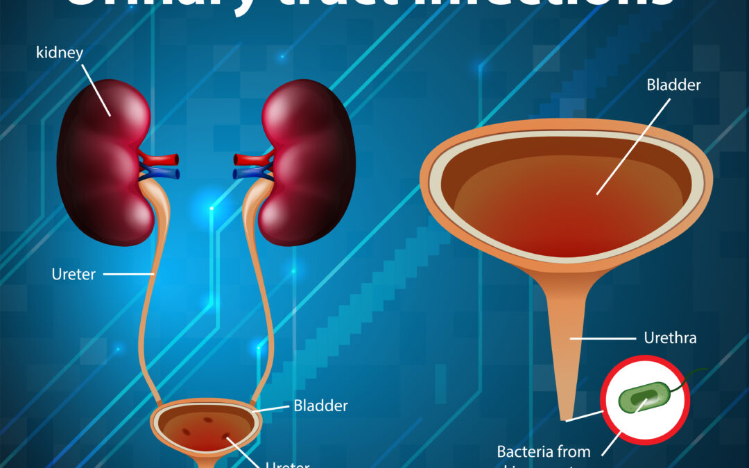 Urinary Tract Infection: Top 8 Myths And Truths