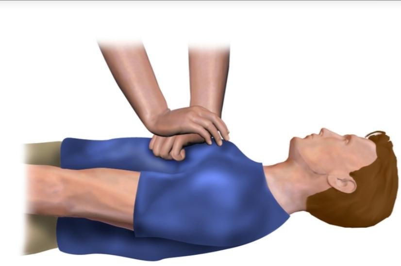 CPR Step 2